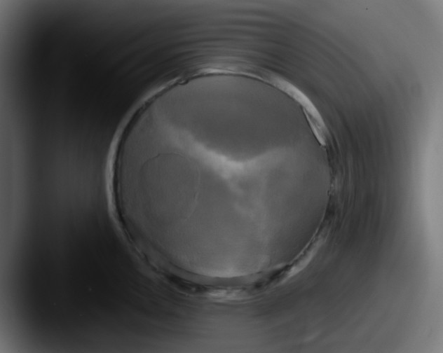 X0000087541146200705181044