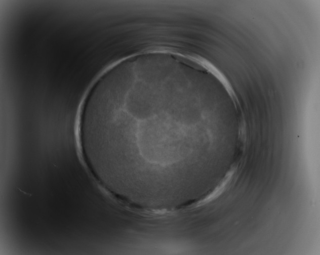 X0000087541149200705181044