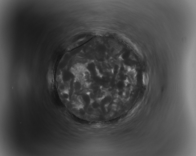 X0000087541155200705181043