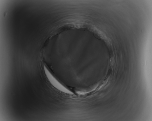 X0000087541202200705181042