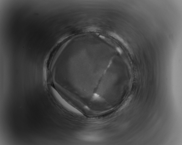 X0000087541219200705181042