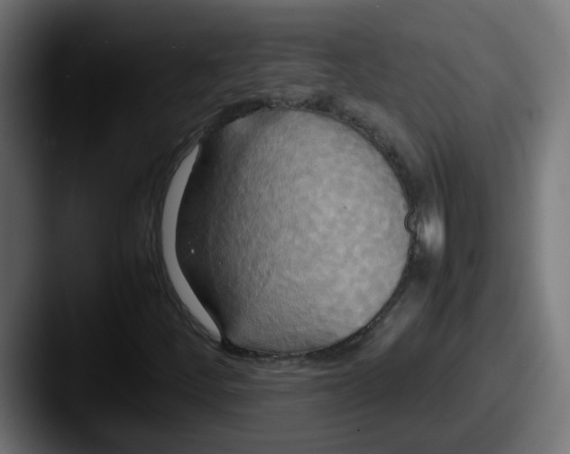 X0000087541252200705181042