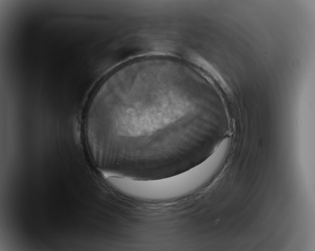 X0000087541260200705181042