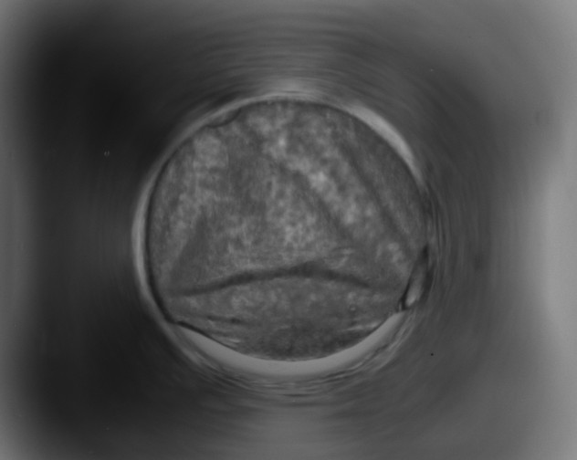 X0000087541391200705181040