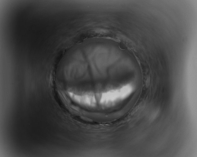 X0000087541397200705181040