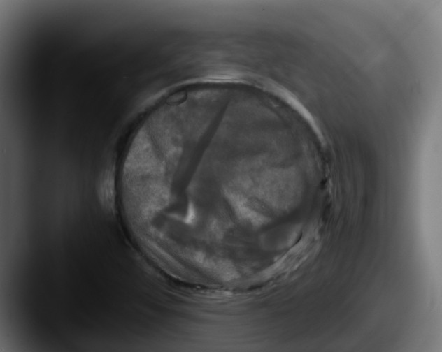 X0000087541456200705181040