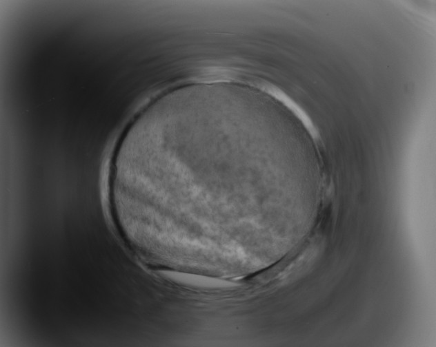 X0000087541477200705181039