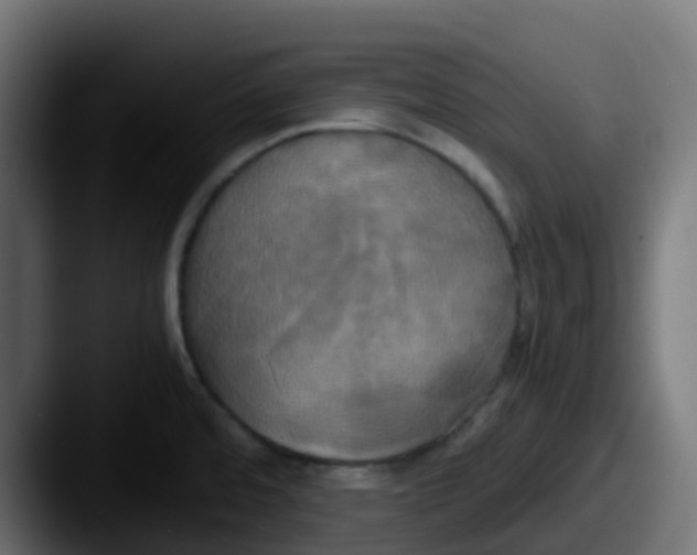 X0000087541480200705181039