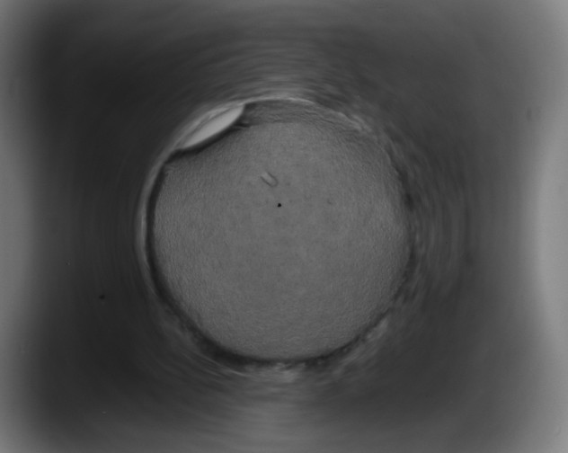 X0000087540148200705251727