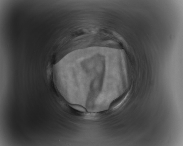 X0000087540192200705251727