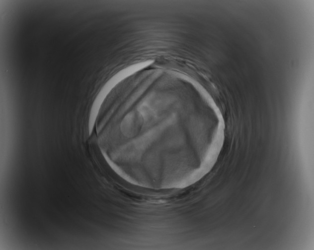 X0000087540570200705251722