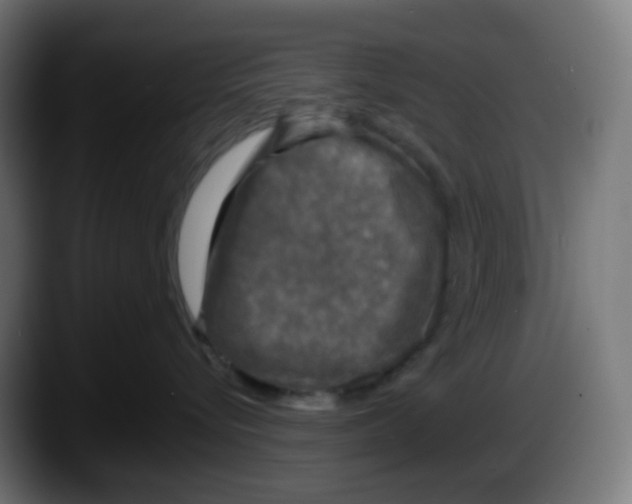 X0000087540576200705251722