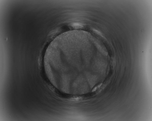 X0000087540760200705251720