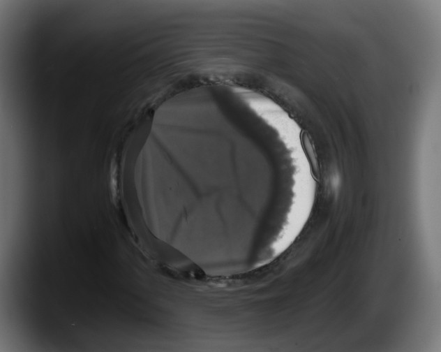 X0000087541060200705251715