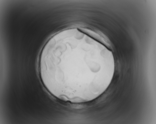 X0000087541103200705251715