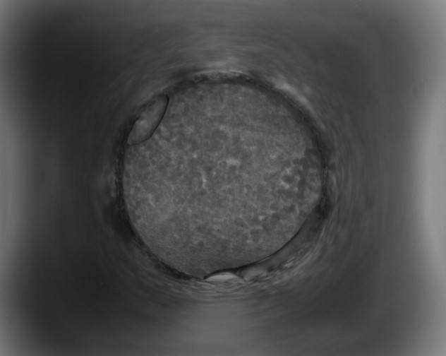 X0000087541159200705251714