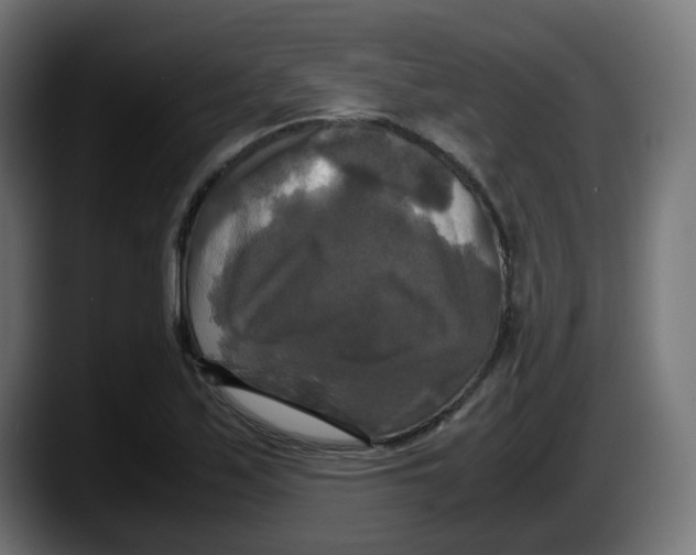 X0000087541171200705251714