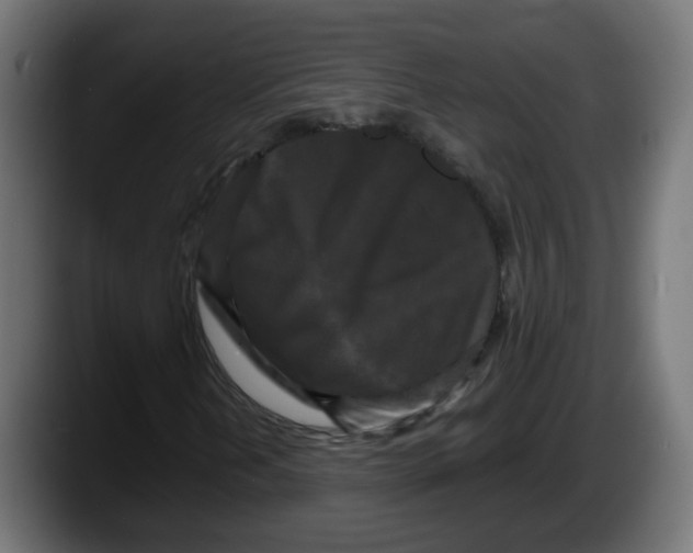 X0000087541202200705251713