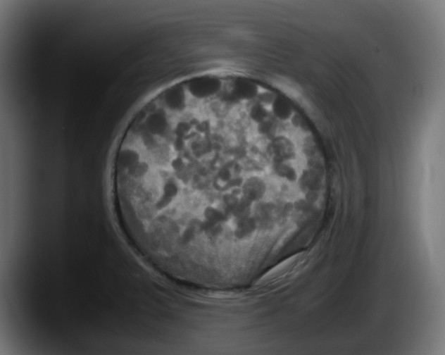 X0000087541375200705251711