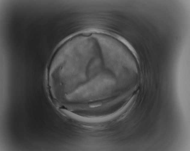 X0000087541388200705251711