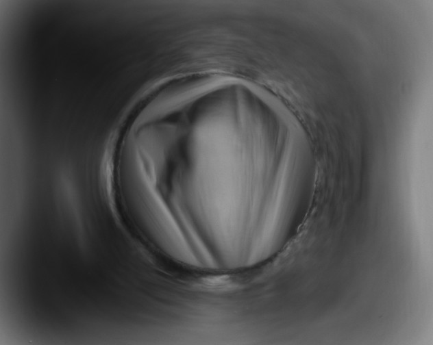 X0000087550054200705181114