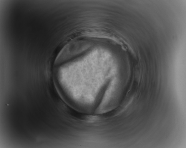 X0000087550085200705181114