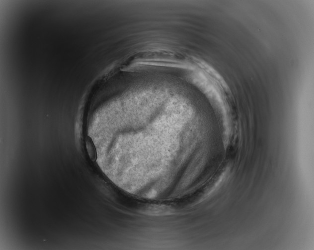 X0000087550399200705181110