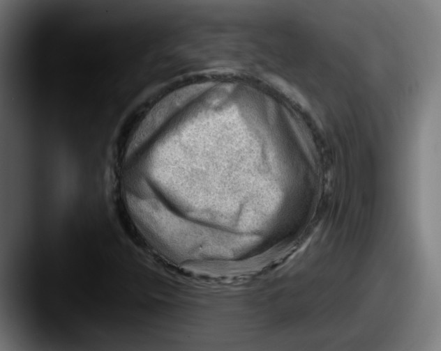 X0000087551400200705181058