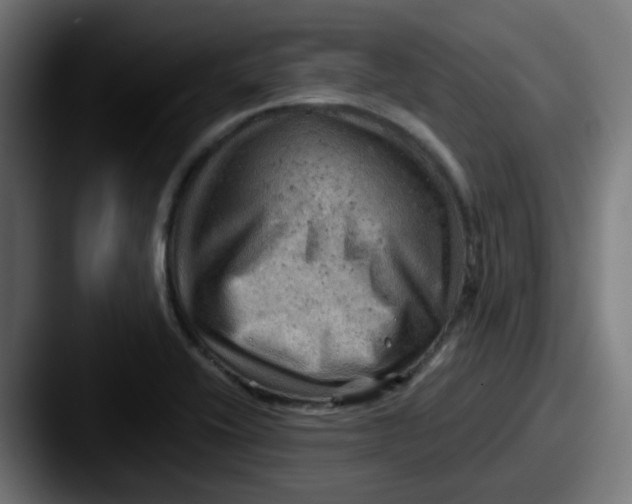 X0000087551416200705181058