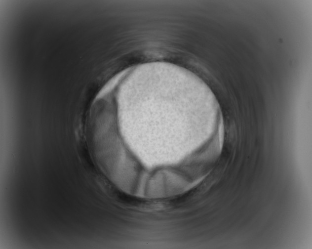 X0000087550418200705251744