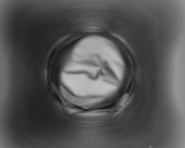 X0000087551402200705251731