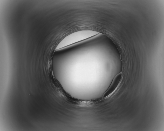 X0000087560192200704270932