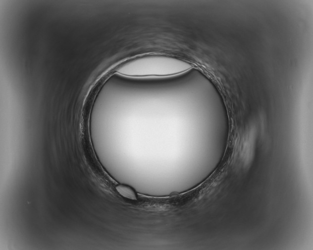 X0000087560247200704270931