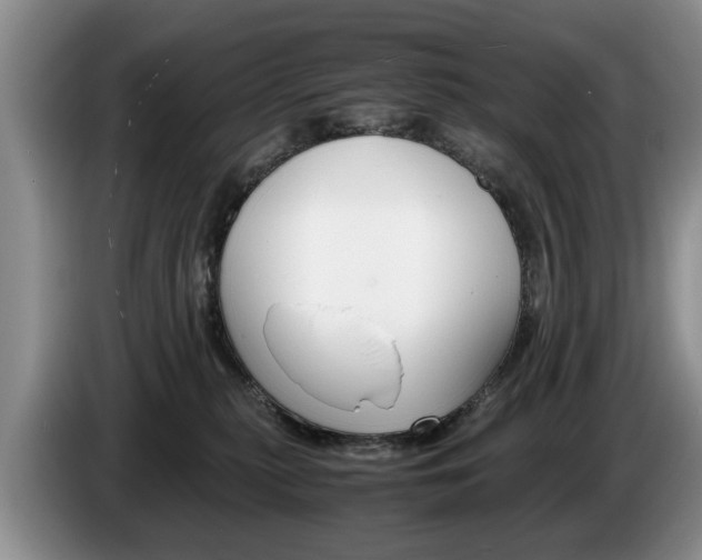 X0000087560279200704270931