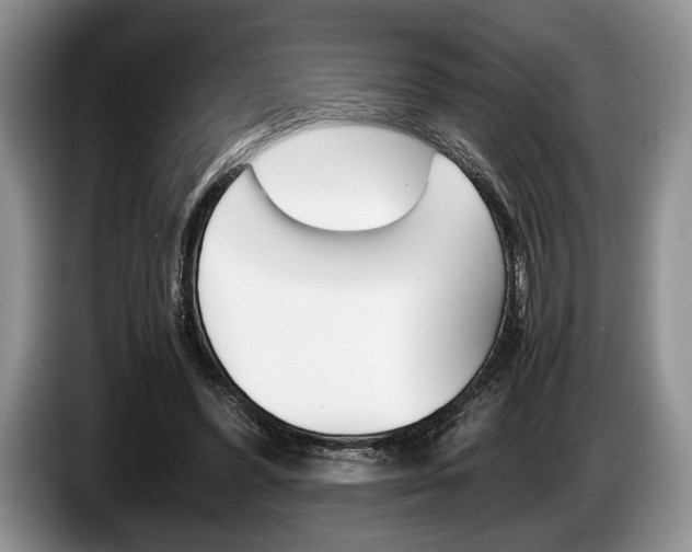 X0000087560396200704270929