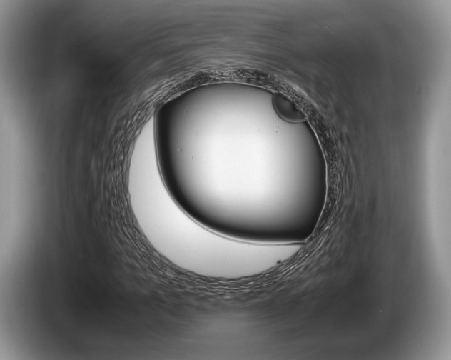 X0000087560965200704270923