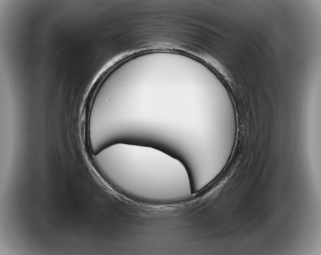 X0000087561126200704270921