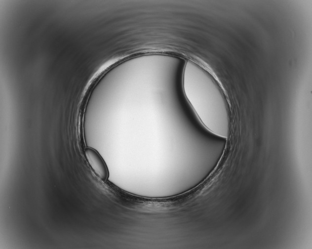 X0000087561179200704270920