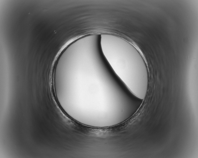 X0000087561195200704270920