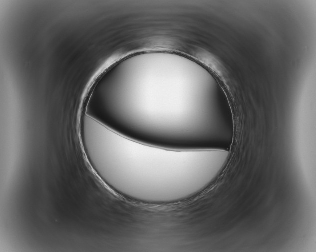 X0000087561480200704270917