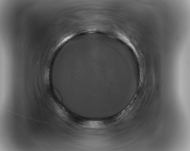 X0000087560154200704271232