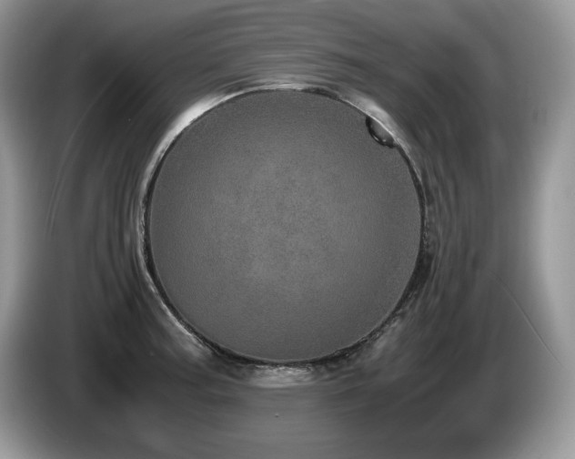 X0000087561187200704271220