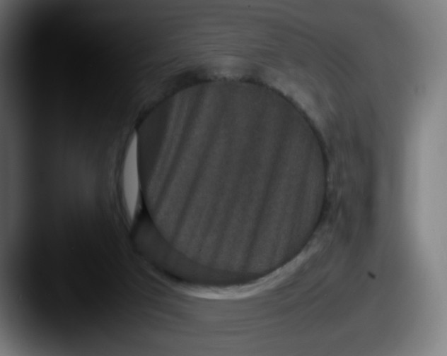 X0000087560017200705181133