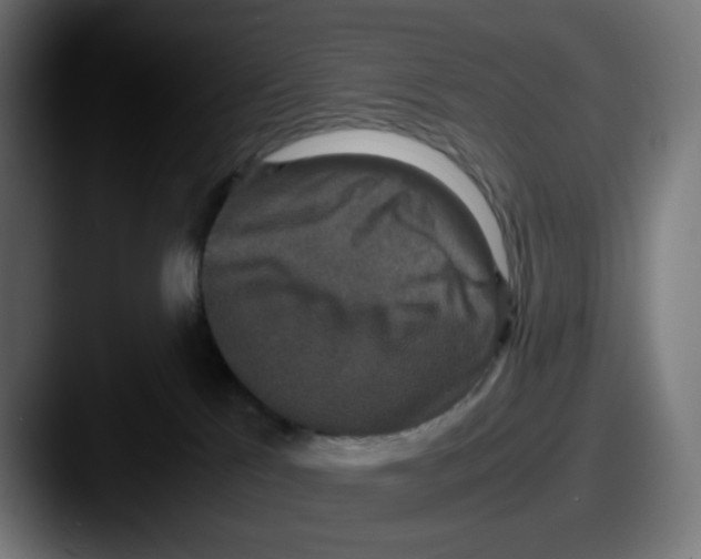 X0000087560041200705181132