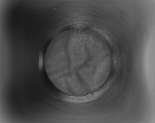 X0000087560042200705181132