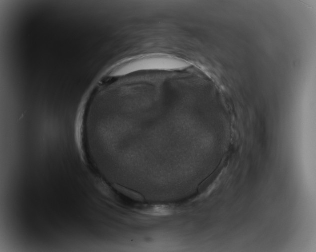 X0000087560056200705181132