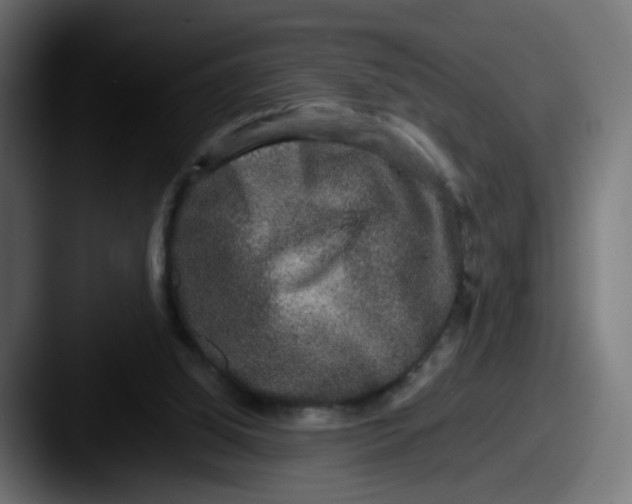 X0000087560060200705181132