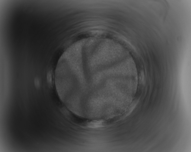 X0000087560138200705181131