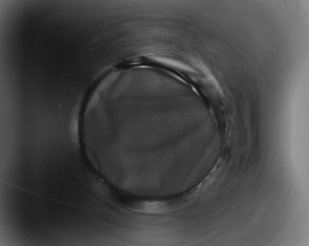 X0000087560154200705181131
