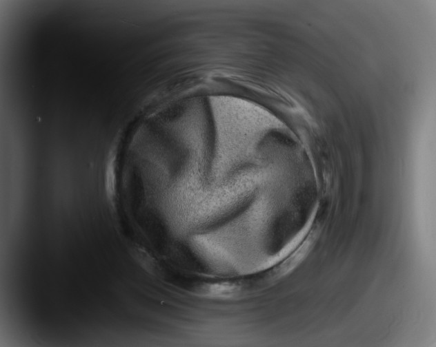 X0000087560158200705181131